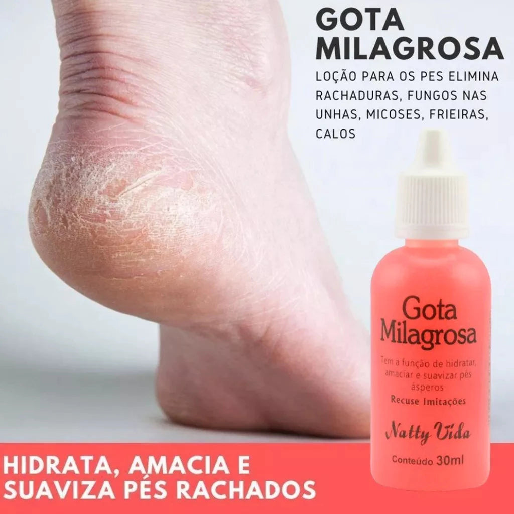 Kit ANTI RACHADURAS! Gota Milagrosa + Sebo de Carneiro + Creme Miconaze - Perfeito para os Pés